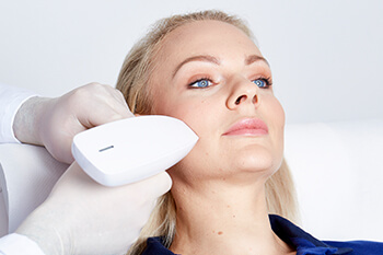 Behandlung Aknenarben entfernen / korrigieren mittels medizinischem, high tech Fraxel Laser. Aknenarben können effektiv und hautschonend entfernt bzw. stark verbessert werden.